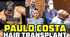 Paulo Costa Gets A Hair Transplant Because Of "Secret Juices" Side Effects?