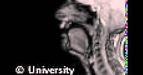 MRI voiceless alveolo-palatal fricative