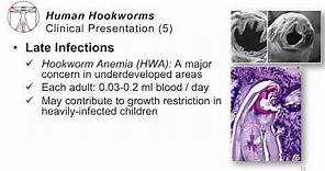 Helminths Hookworms