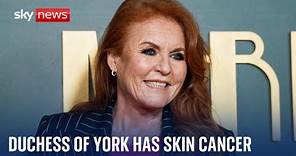 Duchess of York Sarah Ferguson is receiving treatment for skin cancer