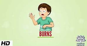 Burns, Causes, Signs and Symptoms, Diagnosis and Treatment.