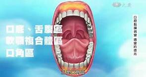 【口腔癌】口腔黏膜病變 癌變的徵兆