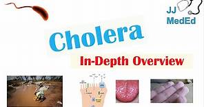 Cholera (Vibrio Cholerae) Pathophysiology, Risk Factors, Symptoms, Diagnosis, and Treatment