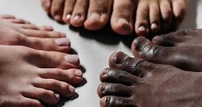 手指、腳趾黑點恐是病毒疣作祟 常見症狀曝光｜東森新聞