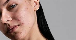 Clínica de Dermatología | Reina Madre