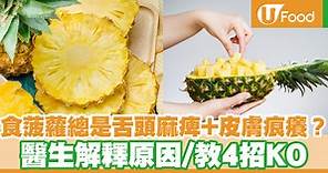 吃菠蘿總是舌頭麻痺兼皮膚痕癢？ 醫生解釋原因／4招輕鬆解決 - UFood - 最hit 食訊 - 健康食訊 | U Food 香港餐廳及飲食資訊優惠網站