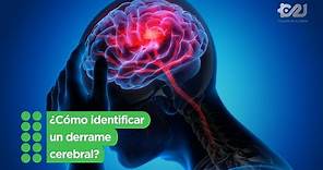 ¿Cómo identificar un derrame cerebral?