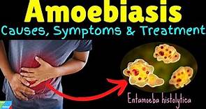 Amoebiasis | Amebiasis | Amoebic Dysentery – Symptoms, Causes, Treatment, Complications, Preventions
