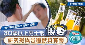 【男人最痛】30歲以上男士常脫髮　研究揭與含糖飲料有關 - 香港經濟日報 - TOPick - 健康 - 食用安全