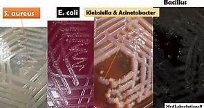 Most Common Bacterial Colony Morphology/ E. coli/Klebsiella/Pseudomonas/Proteus/Staphylococcus/Baci