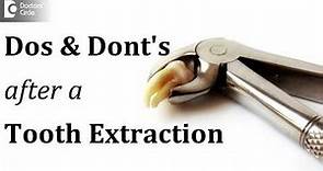 Dos and Dont's after a tooth extraction - Dr. Sathyadeep. V
