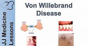 Von Willebrand Disease | Pathophysiology, Types, Symptoms and Treatment