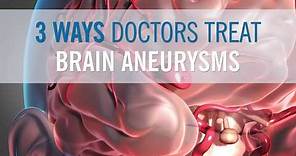 3 Ways Doctors Can Treat Your Brain Aneurysm