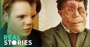 The Ugly Face of Disability Hate Crime (Adam Pearson Documentary) | Real Stories