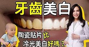 牙齒美白:陶瓷貼片比美白貼或冷光美白好嗎?｜林榆芩醫師