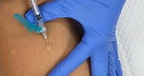 How To Give an Intradermal Injection | PPD | TB Test | Medical Assisting