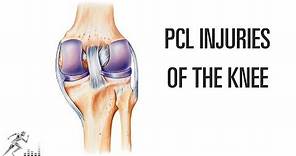 PCL injury of the knee: Mechanism of injury and treatment options
