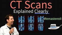 High Resolution CT Scan (HRCT) Explained Clearly - Remastered