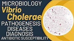 Vibrio cholerae cholera | Vibrio cholerae microbiology | Pathogenesis, lab diagnosis