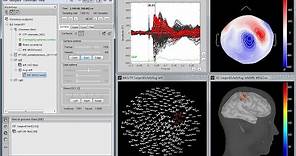 Brainstorm: Imaging neural activity at the speed of brain