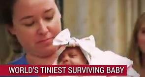 World's Tiniest Surviving Baby