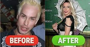 CELEBRITY BEFORE AND AFTER PLASTIC SUERGERY | ALEXIS ARQUETTE