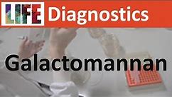 Galactomannan testing for disseminated Aspergillus/Talaromyces/Histoplasma infections