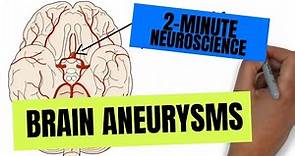 2-Minute Neuroscience: Brain Aneurysms