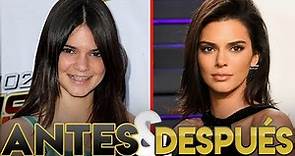 Kendall Jenner | Transformación Antes y Después | Cirugías Estéticas