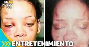 Salen a la luz nuevas fotos de Rihanna con golpes en el rostro | Un Nuevo Día | Telemundo
