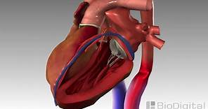 3D Medical Animation - Congestive Heart Failure