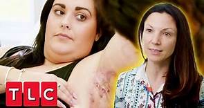 Dr Emma Treats Woman with Chronic Abscesses That Could Burst Any Moment! | The Bad Skin Clinic