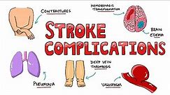 Post Stroke Complications - What are the most common complications of stroke?