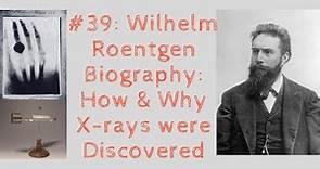 Wilhelm Roentgen Biography: How & Why X-rays were Discovered