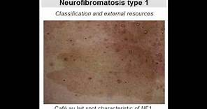 Neurofibromatosis Type 1 (von Recklinghausen's Disease)