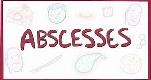 Abscesses - causes, symptoms, diagnosis, treatment, pathology
