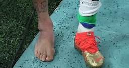 Así quedó el tobillo de Neymar: la lesión lo deja temporalmente fuera del Mundial | Video