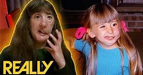 Woman With Facial Deformity Since Childhood Is Terrified Of Getting Surgery | Body Bizarre