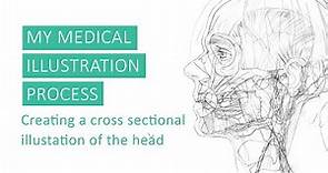 A Brief Overview of my Medical Illustration Process by Annie Campbell