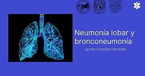 Neumonía lobular, Bronconeumonía y Daño Alveolar Difuso