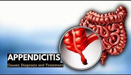 Appendicitis, Causes, Signs and Symptoms, Diagnosis and Treatment.