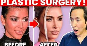 KIM KARDASHIAN Plastic Surgery Transformation - Cosmetic Surgeon Reacts!