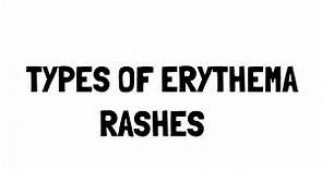 Erythema Rashes
