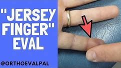 "Jersey Finger" Injury/Avulsion of the Distal Phalynx