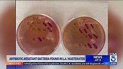 Antibiotic-resistant bacteria found for 1st time in LA County