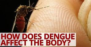 How Does Dengue Affect the Body? #Lifesaver #Dengue #Virus
