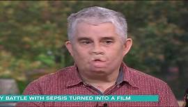Tom Ray describes battle with sepsis ahead of Starfish premiere