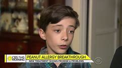 Peanut protein powder shows potential for treating allergies