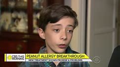 Peanut protein powder shows potential for treating allergies