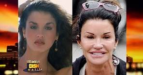 Celebrity Plastic Surgeries -- Before and After!